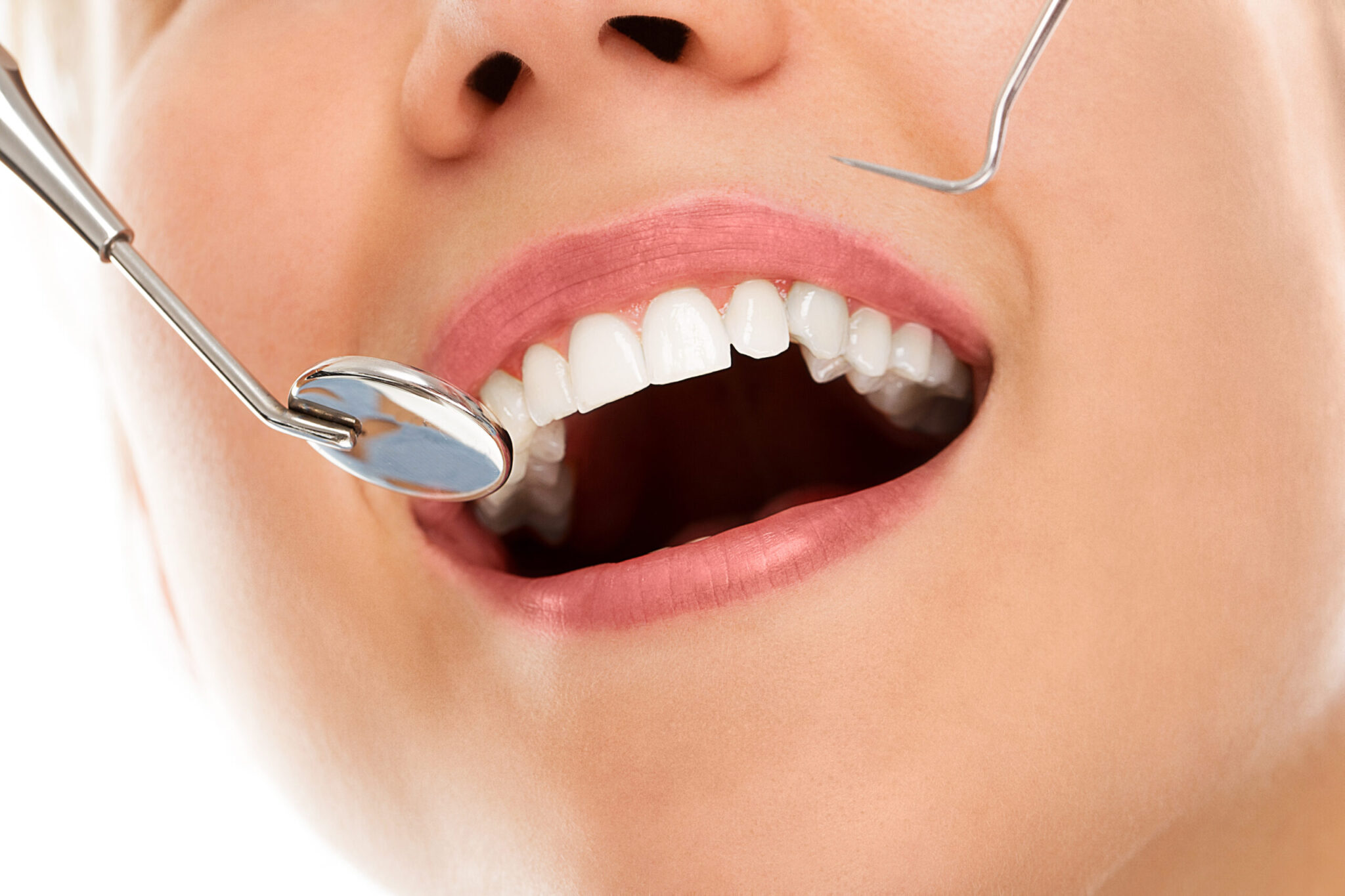 Qué tipos de implantes dentales hay
