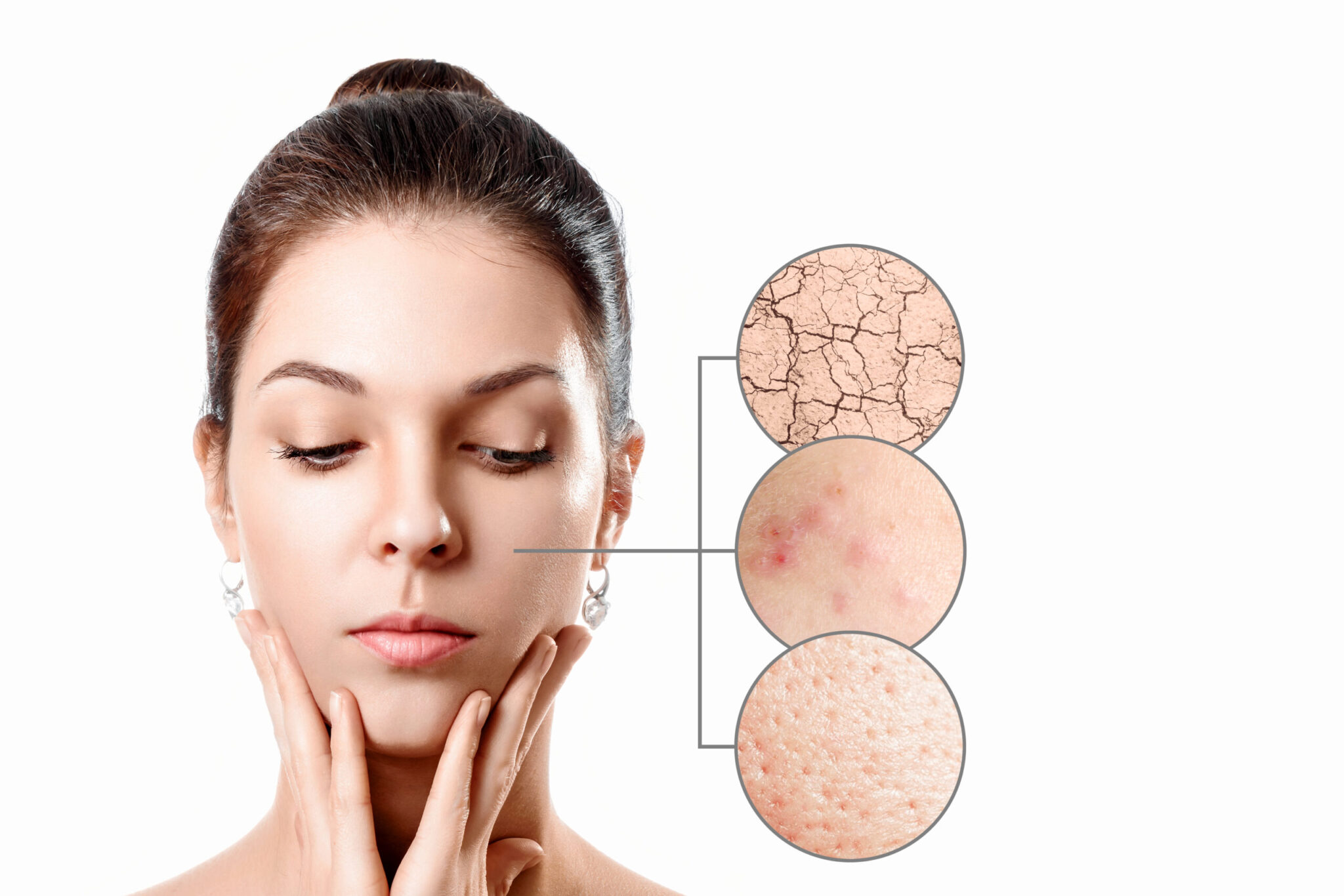 Di adiós al daño físico y emocional provocado por el acné: los mejores tratamientos