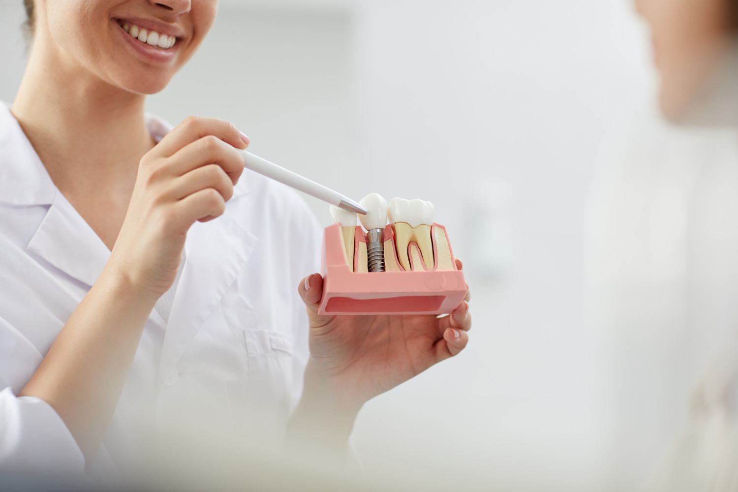 Prótesis dental estética: una solución brillante en el mundo de la odontología