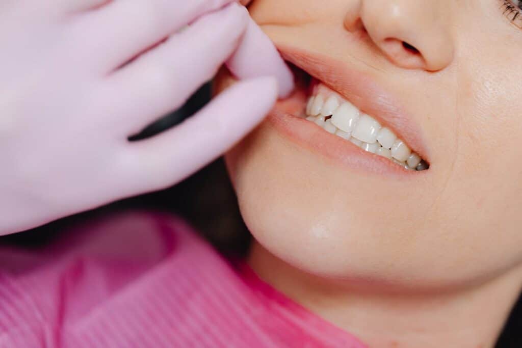 Joyería Dental: la tendencia estética que Ilumina tu sonrisa