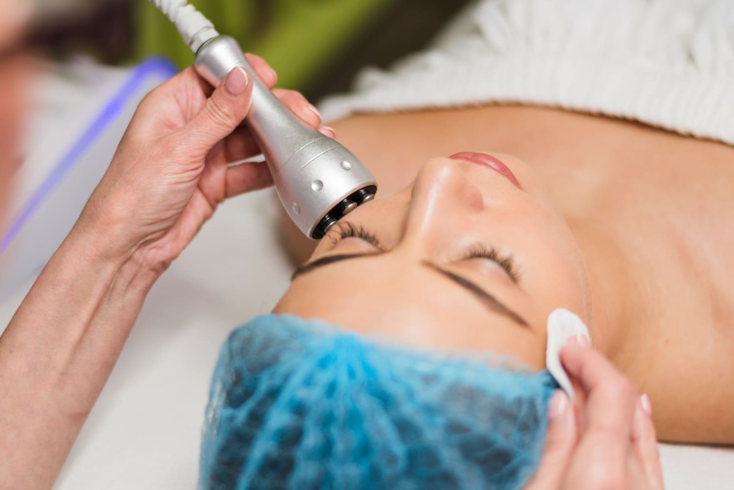 ¿Qué es el tratamiento Indiba y qué beneficios tiene para la piel?