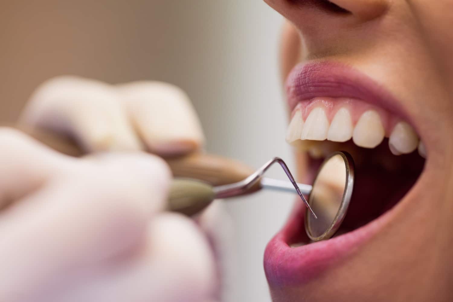 Endodoncia: la importancia de tratar un diente a tiempo antes de que el problema vaya a más