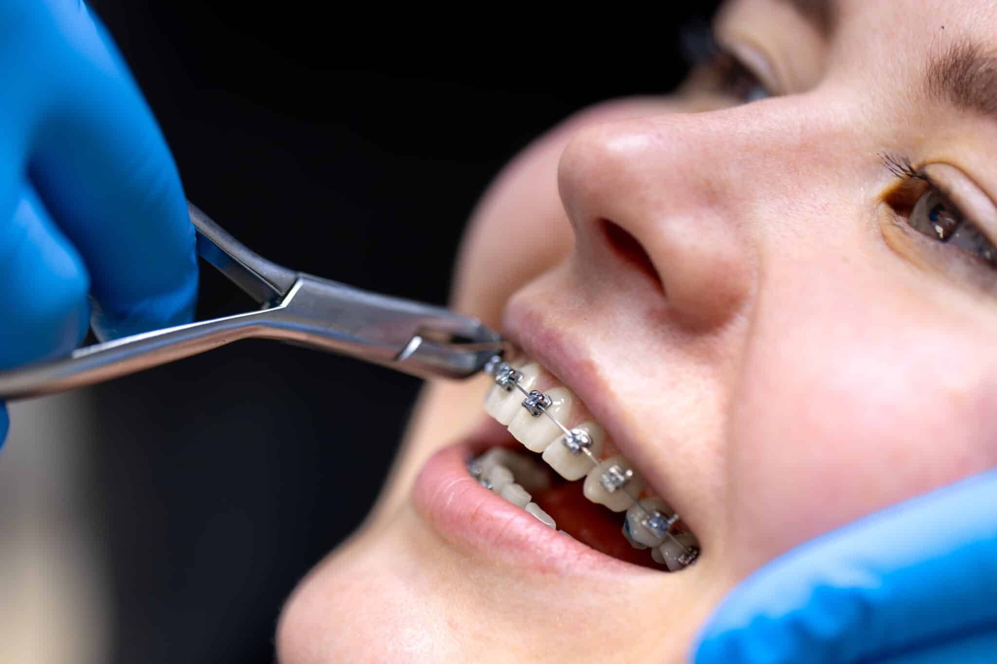 Ortodoncia y diseño de sonrisa: mucho más que alinear dientes
