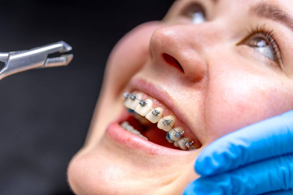 Ortodoncia y diseño de sonrisa: mucho más que alinear dientes