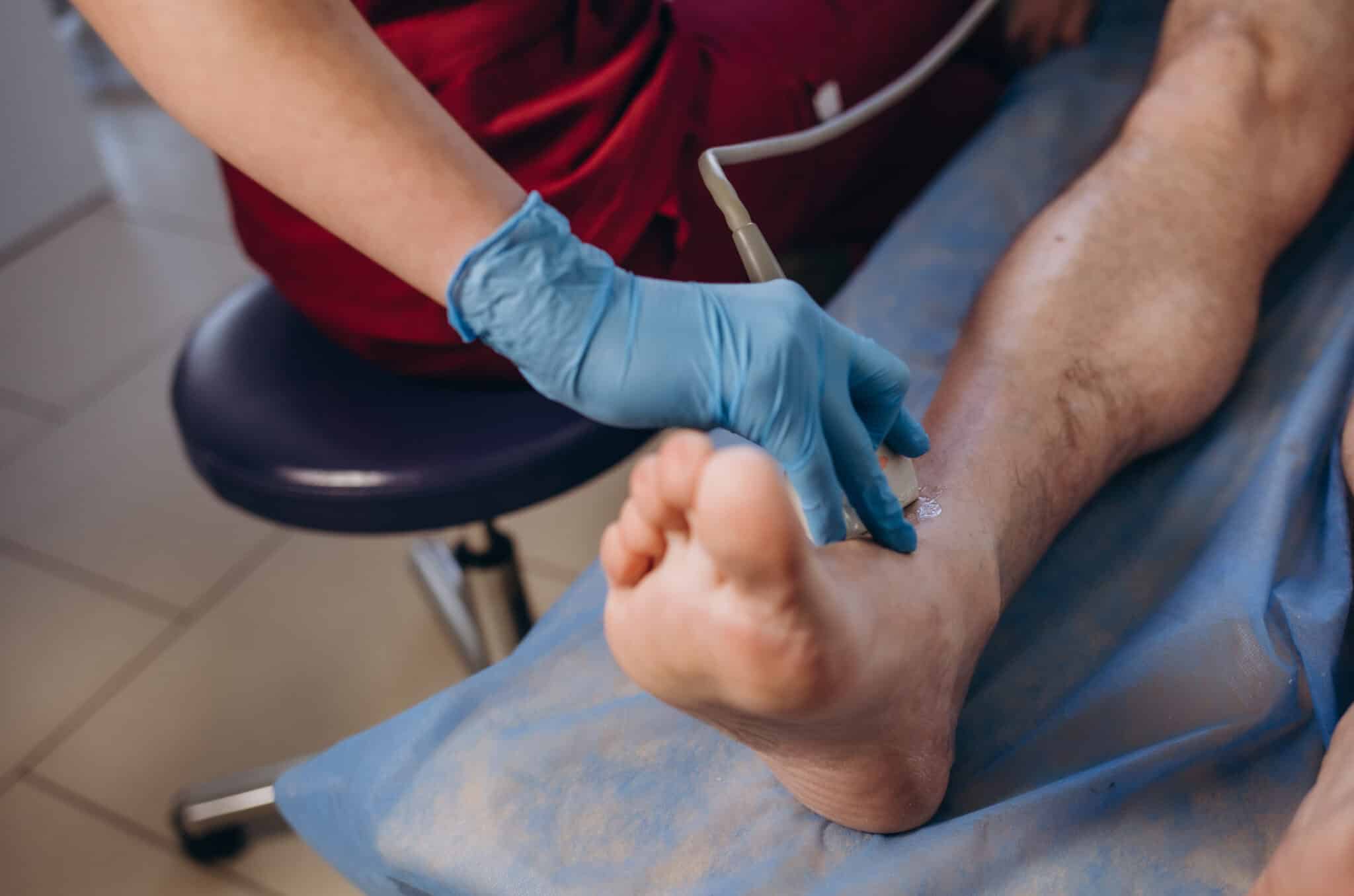 Papilomas plantares: qué son, por qué aparecen y cómo tratarlas