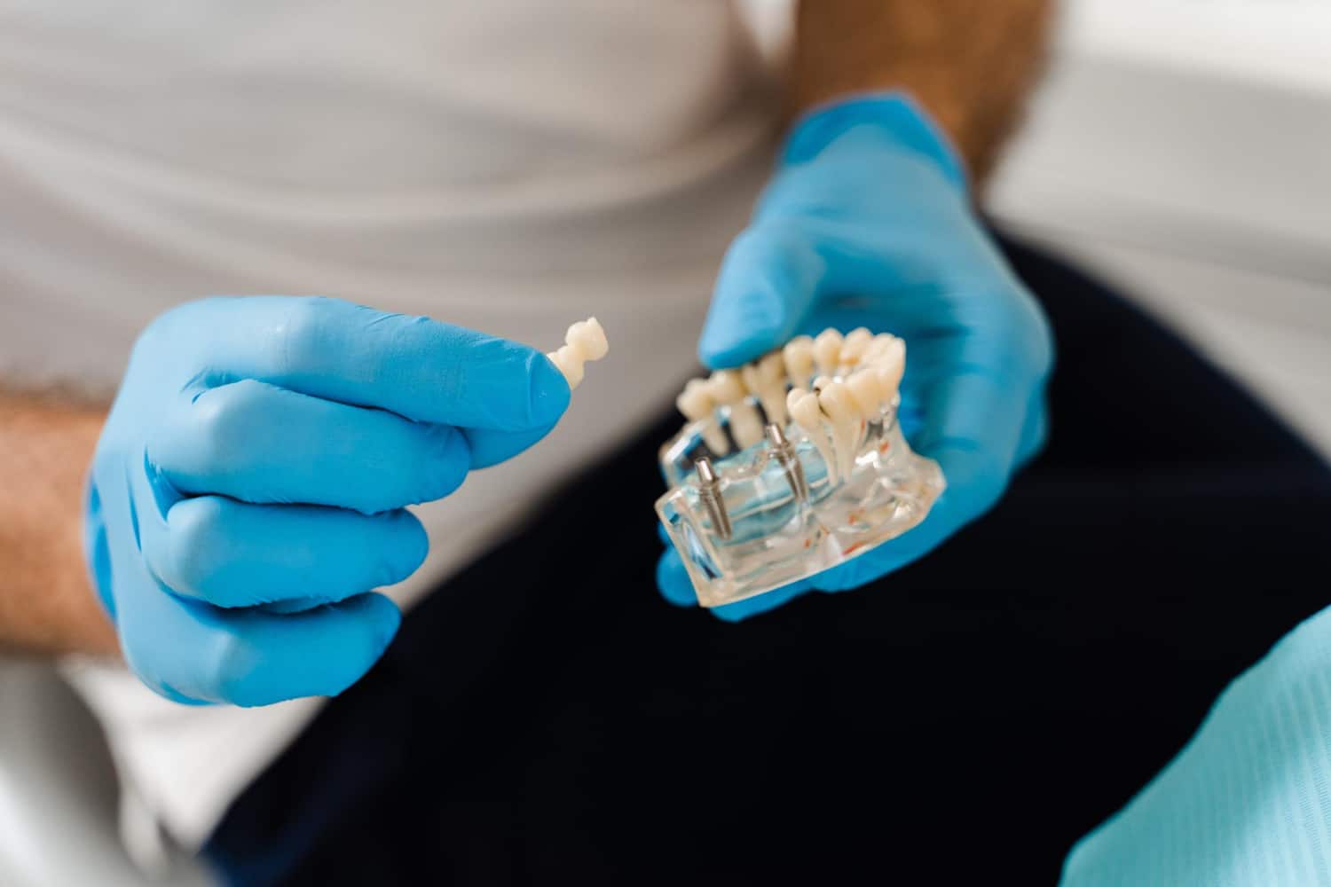 ¿Por qué elegir implantes dentales premium si su precio es más alto y qué diferencias reales existen frente a otras opciones?
