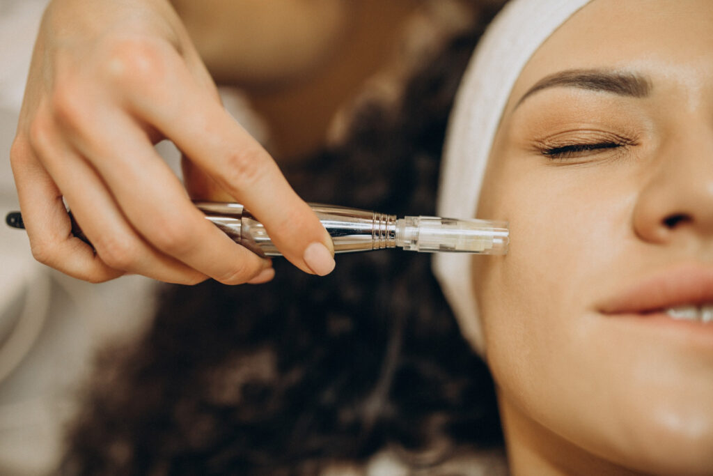 Dermapen: qué es, para qué sirve y cuáles son sus beneficios para la piel